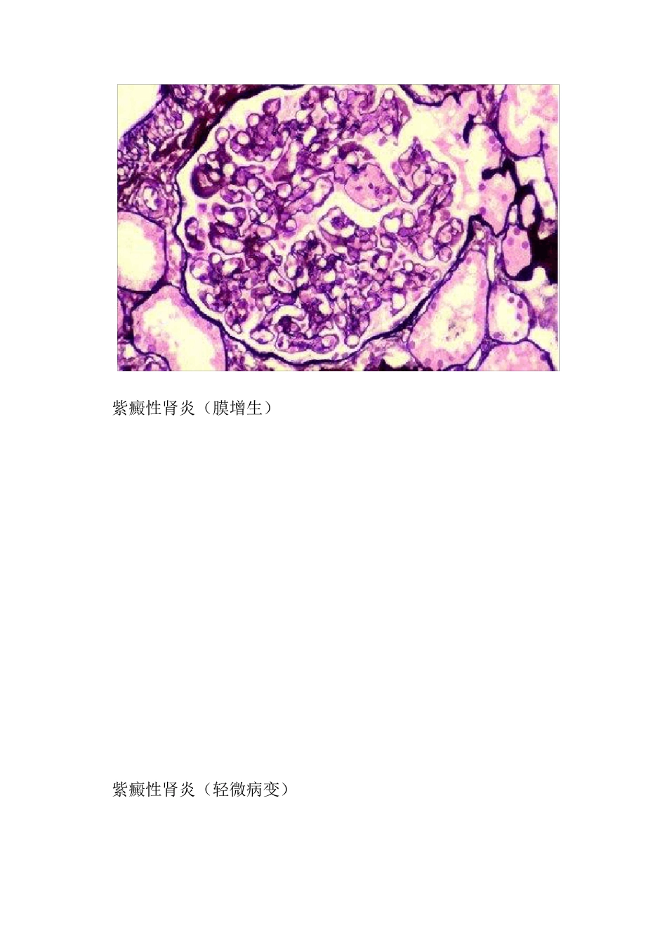 19.各种肾脏病病理图片_第2页