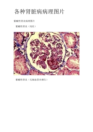 19.各种肾脏病病理图片