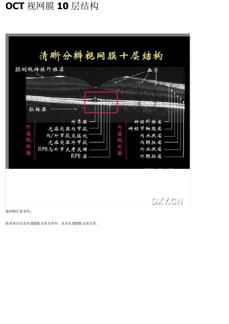 OCT视网膜10层结构讲解_第1页