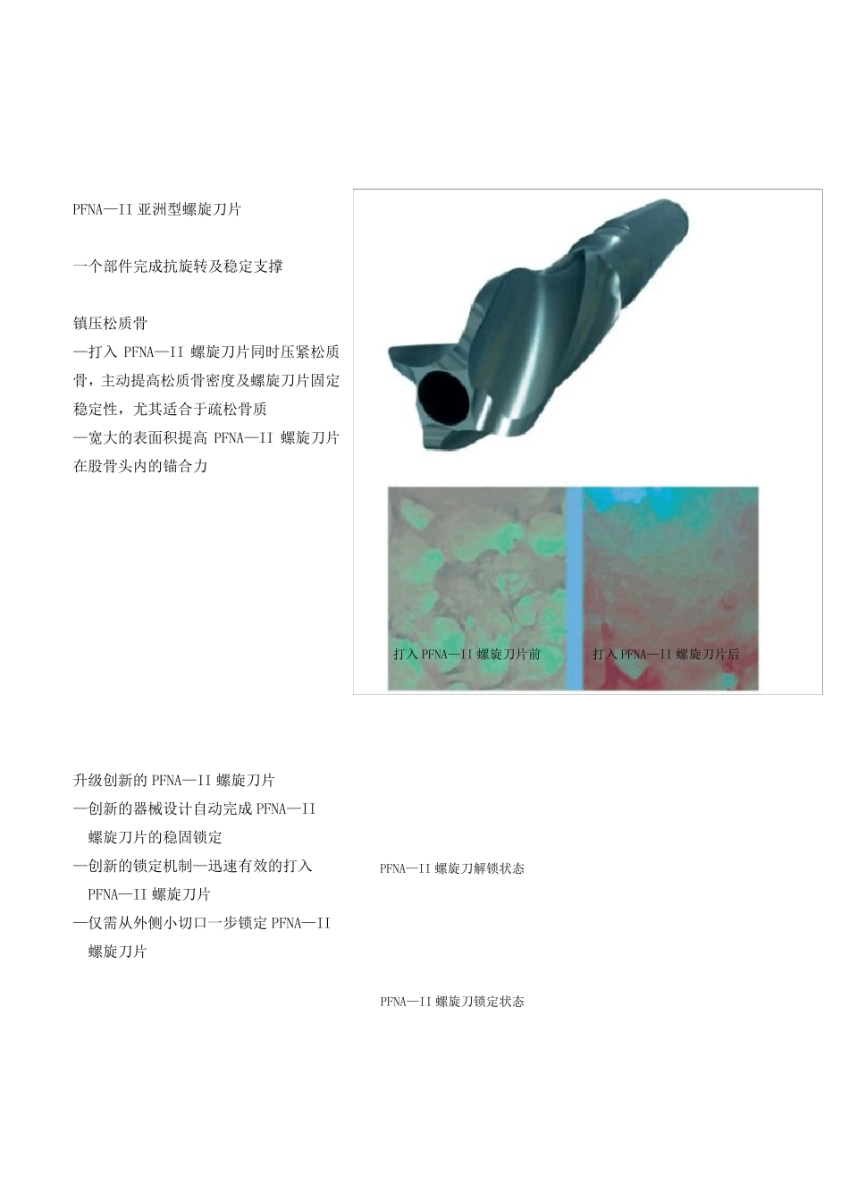 PFNA操作手册_第3页