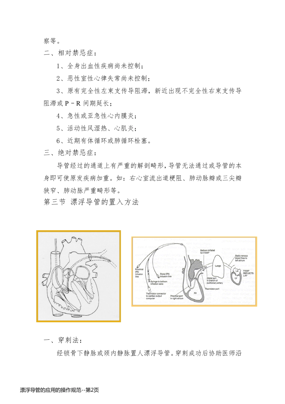 漂浮导管的应用的操作规范_第2页