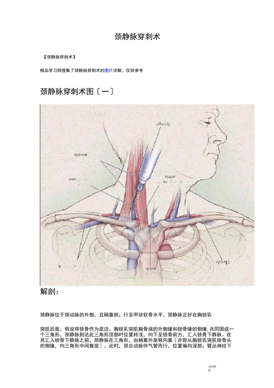颈内静脉穿刺术_第1页