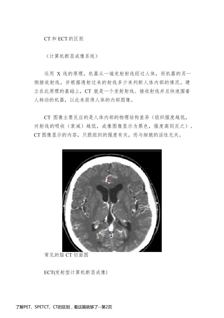了解PET、SPETCT、CT的区别，看这篇就够了_第2页