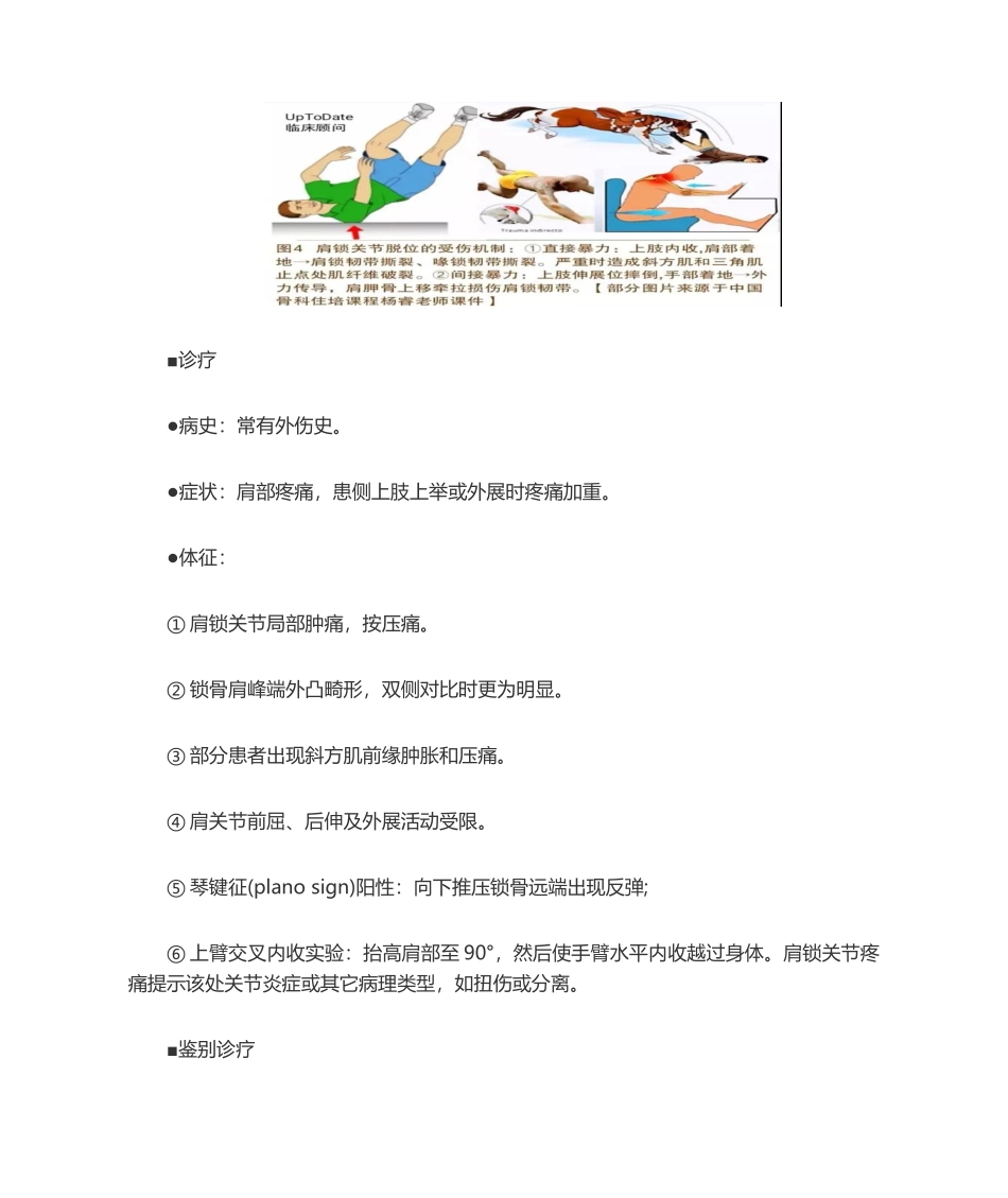 2025年肩锁关节脱位_第3页