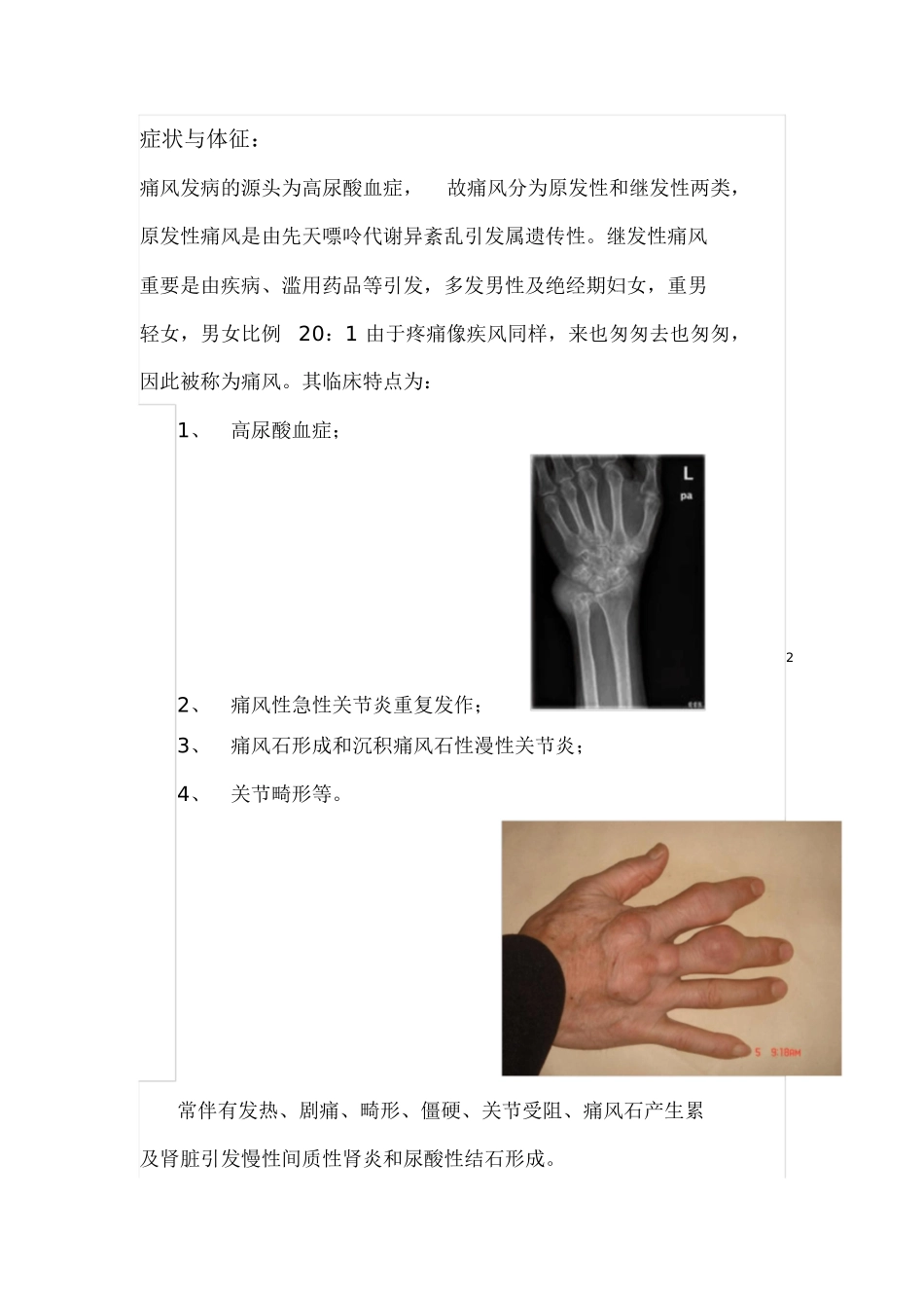2025年痛风健康教育新版_第2页
