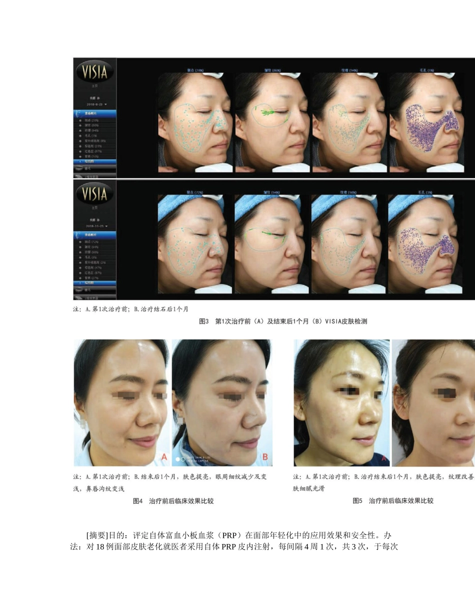 2025年自体富血小板血浆在面部年轻化中的应用_第2页