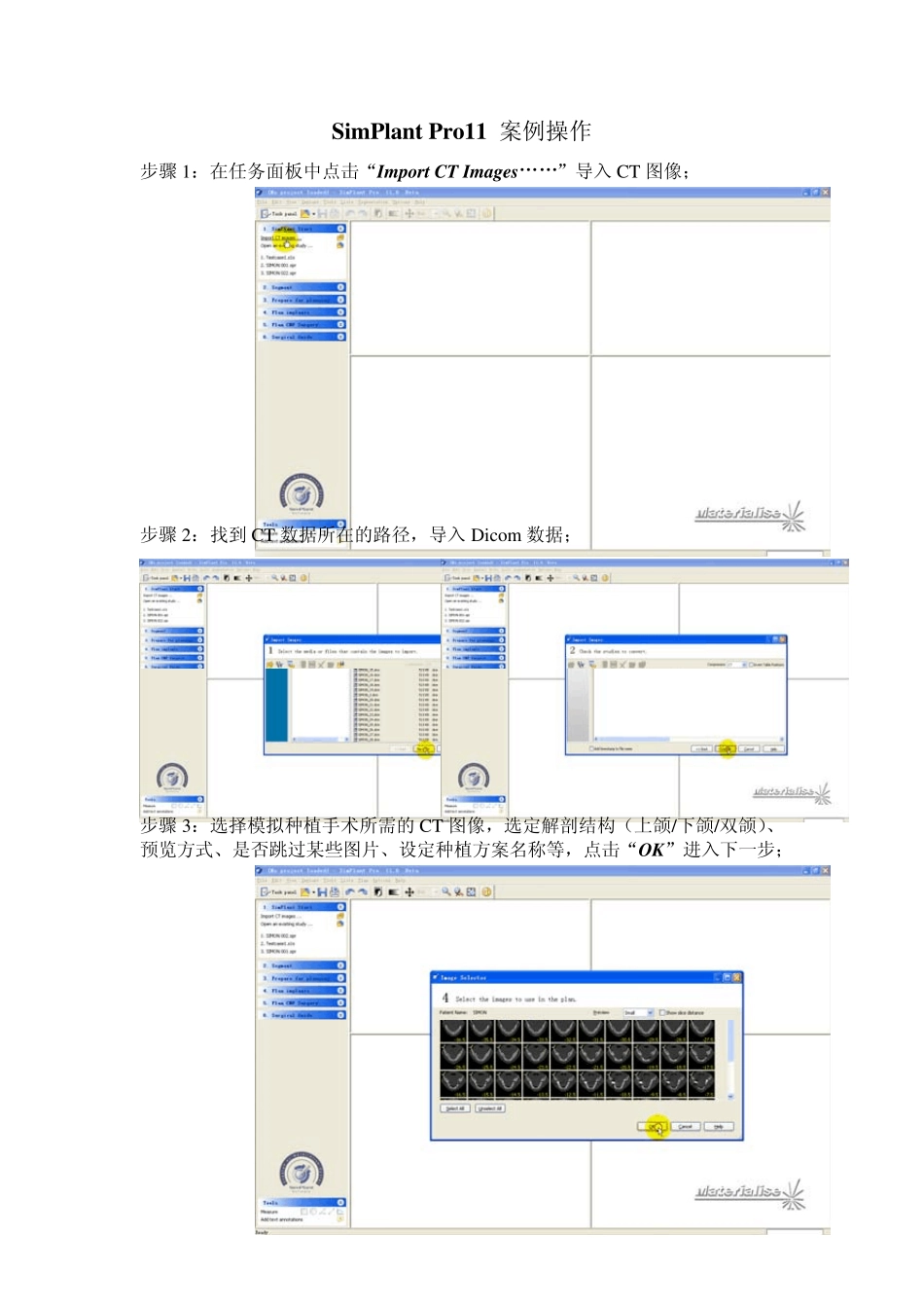 SimPlant操作流程_第1页