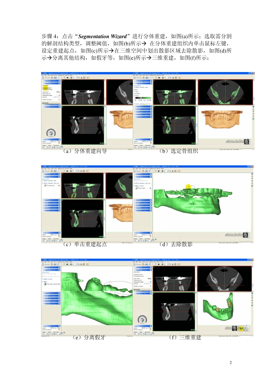 SimPlant操作流程_第2页