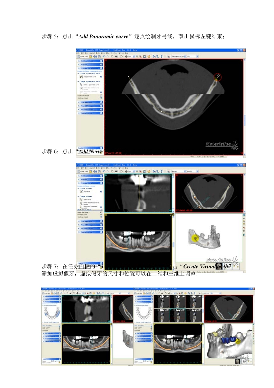 SimPlant操作流程_第3页