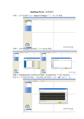 SimPlant操作流程