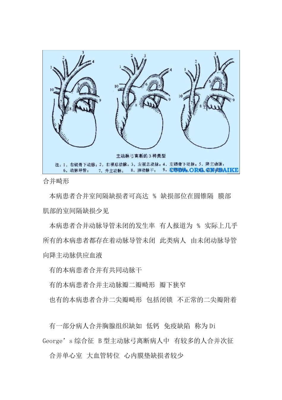 主动脉弓离断_第2页