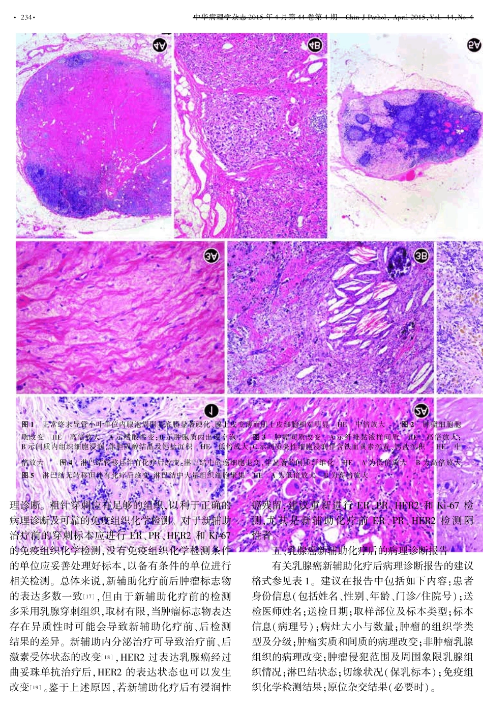 乳腺癌新辅助化疗后的病理诊断专家共识_第3页