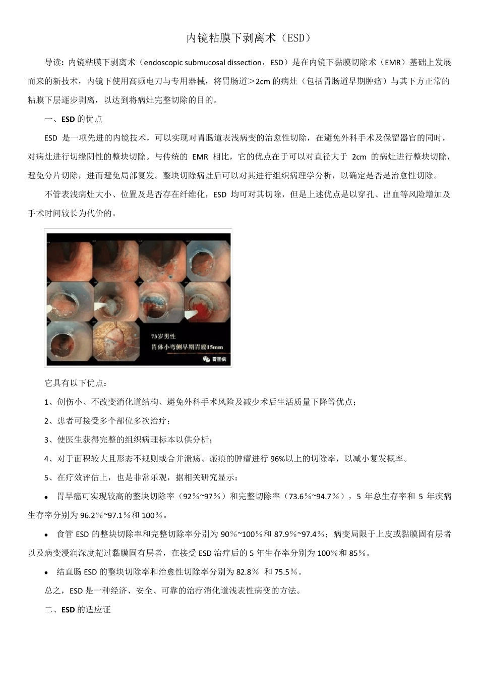内镜粘膜下剥离术(ESD)_第1页
