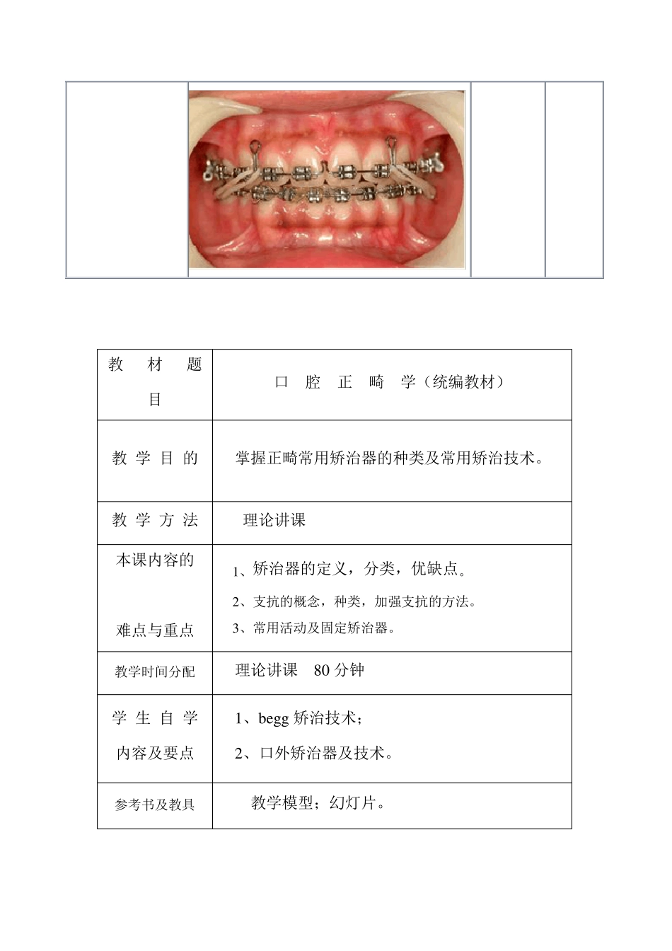 矫治器和矫治技术教案_第3页