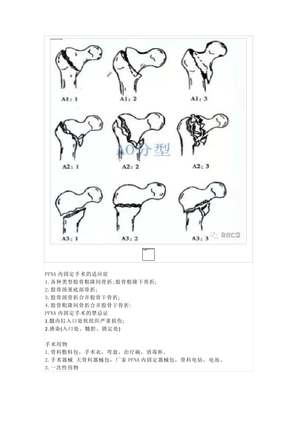 股骨粗隆间骨折PFNA内固定手术的护理配合_第2页