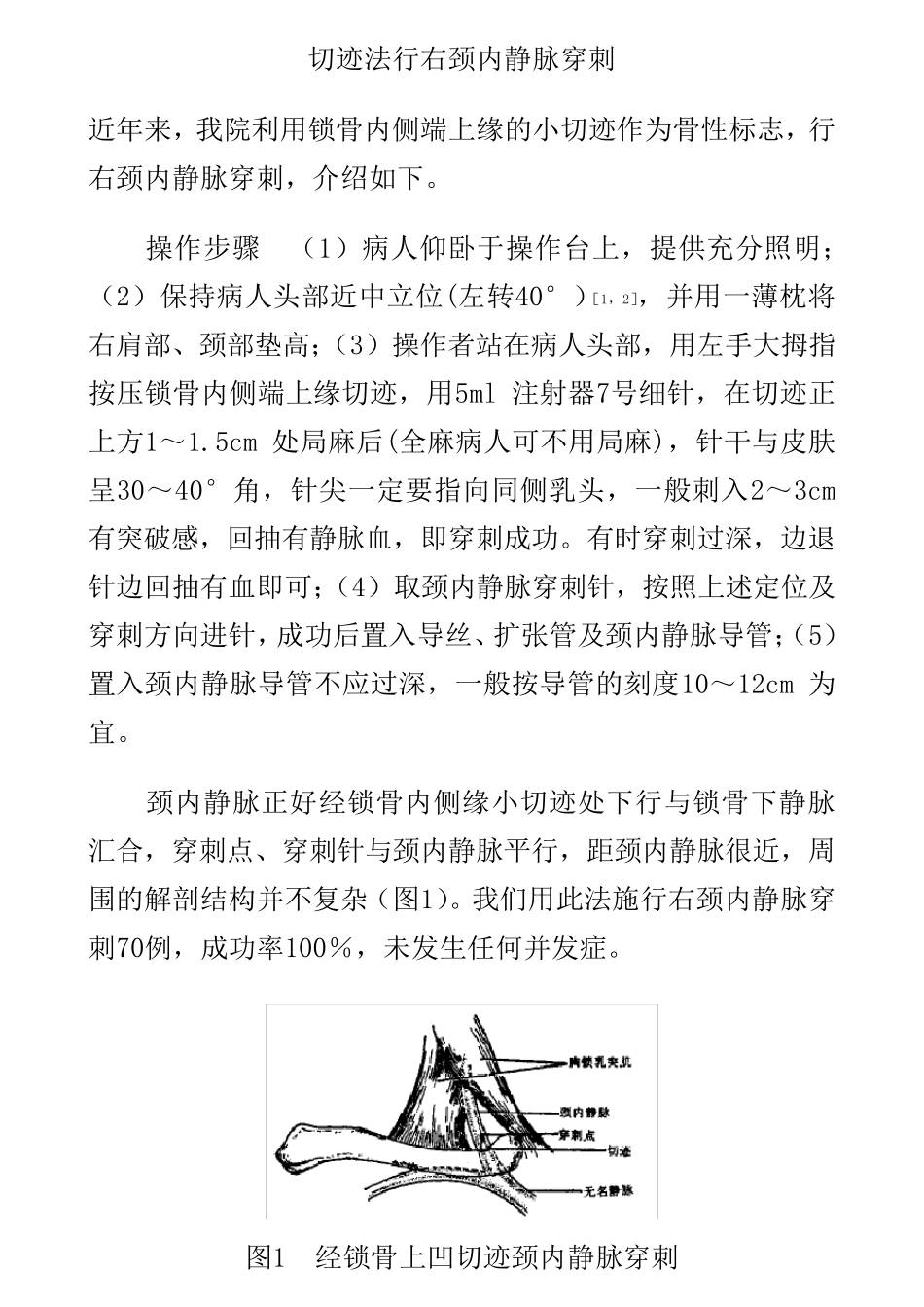 切迹法行右颈内静脉穿刺_第1页