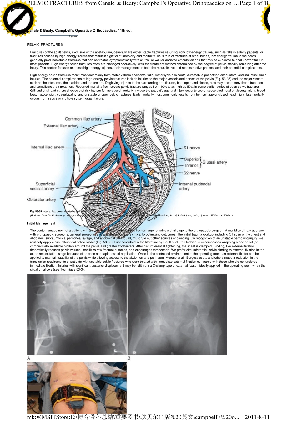 坎贝尔骨科手术学(英文版)_第3卷骨盆骨折_第1页