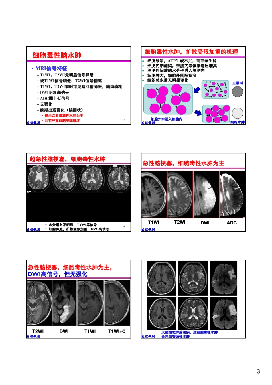 基本病变的MRI信号分析：水肿、坏死及纤维化_第3页