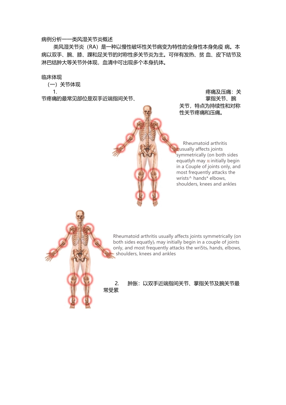 2025年类风湿关节炎病例分析_第1页