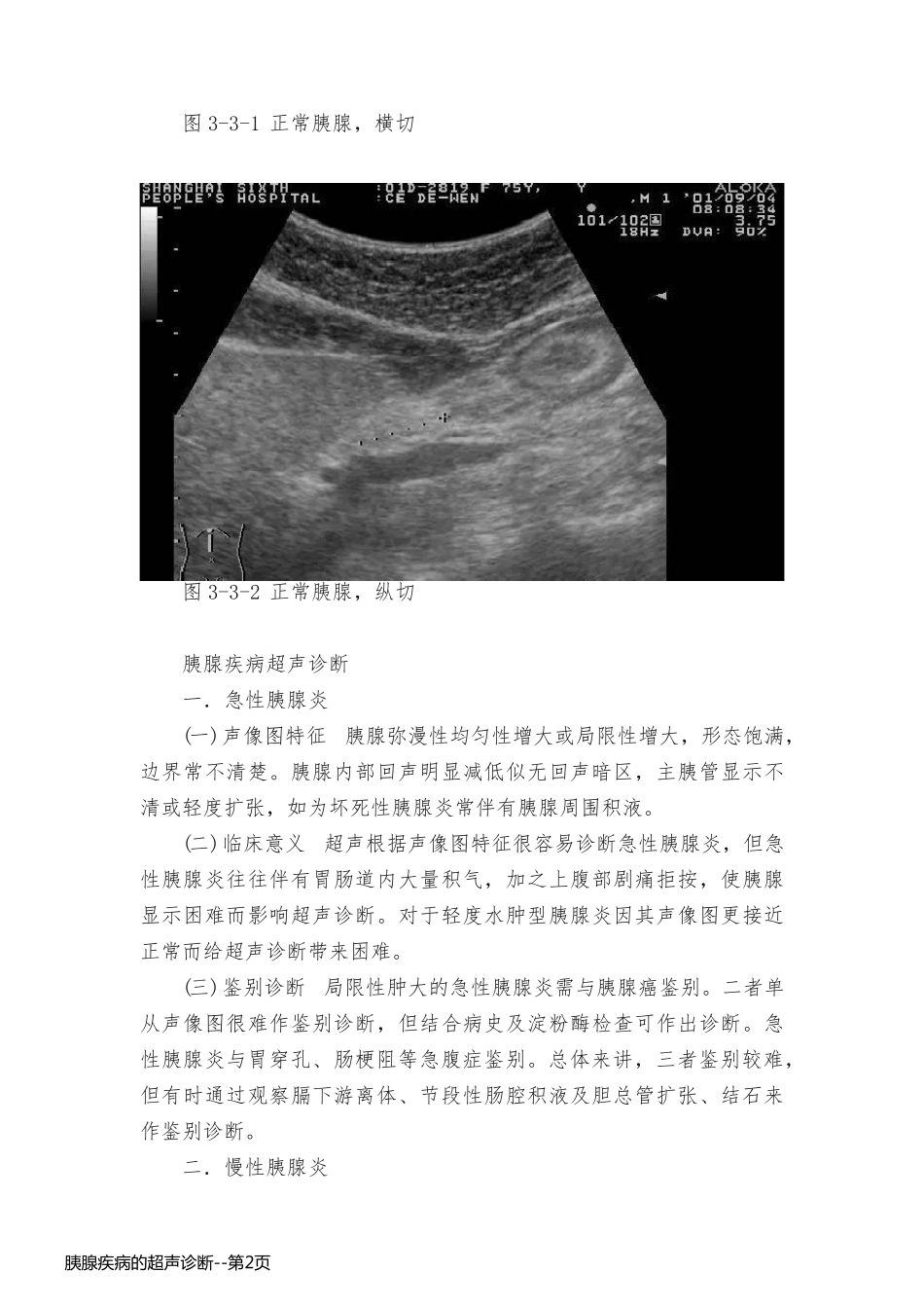 胰腺疾病的超声诊断_第2页