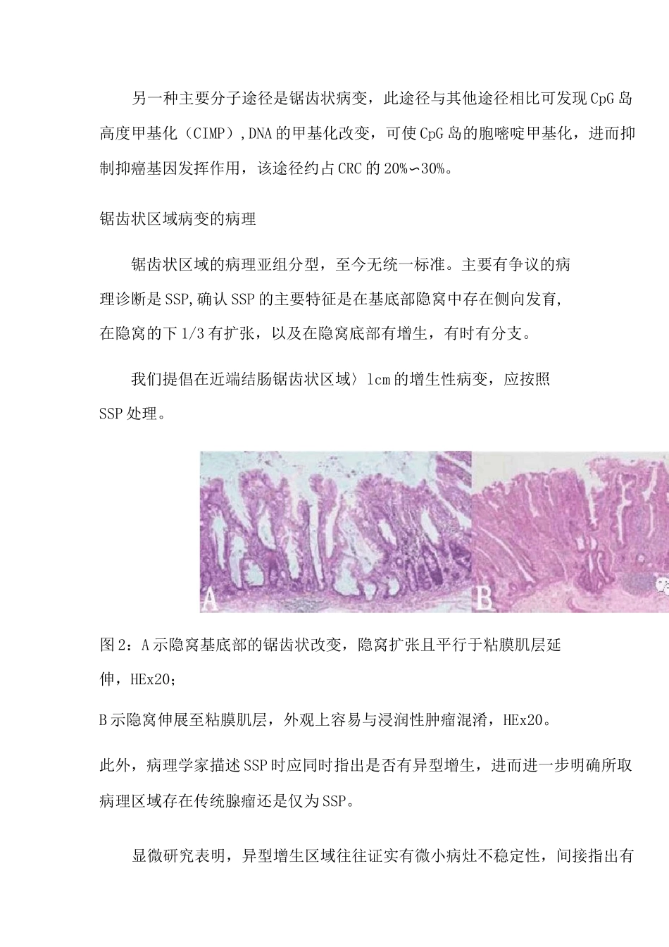 大肠锯齿状病变梳理 _第3页