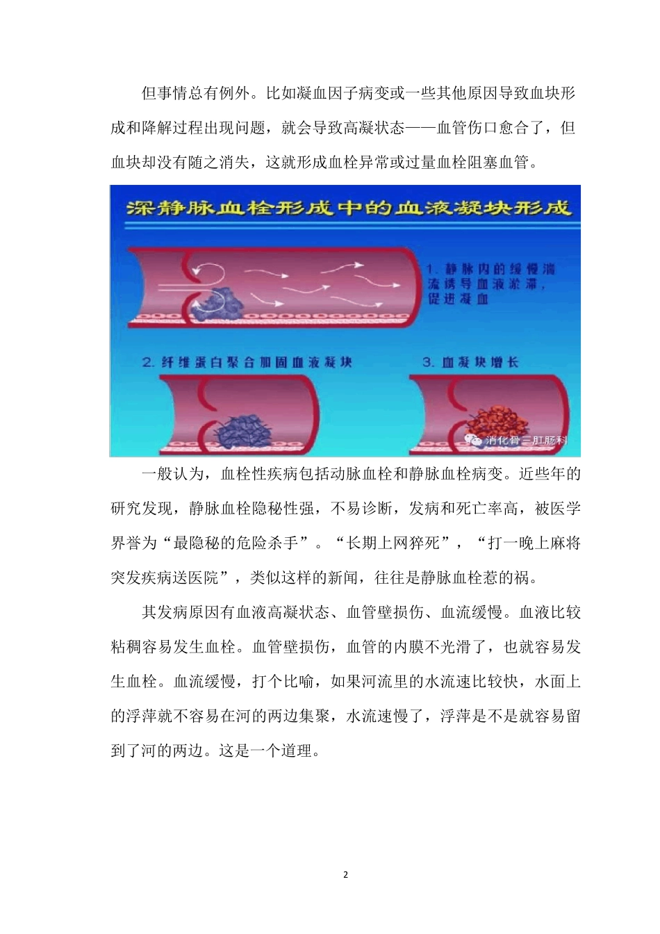 深静脉血栓的预防措施_第2页