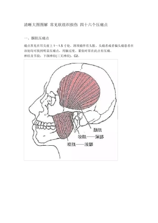 清晰大图图解常见软组织损伤四十六个压痛点