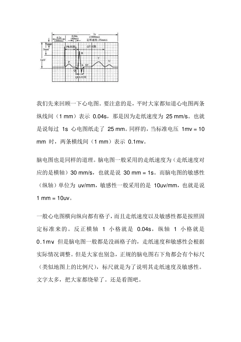 简单说说脑电图_第2页