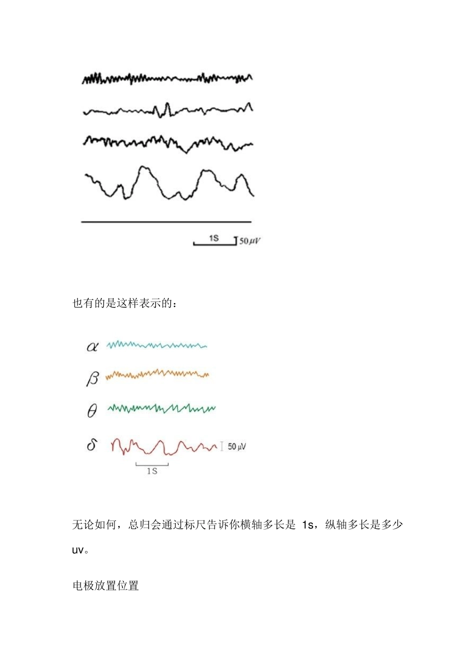 简单说说脑电图_第3页