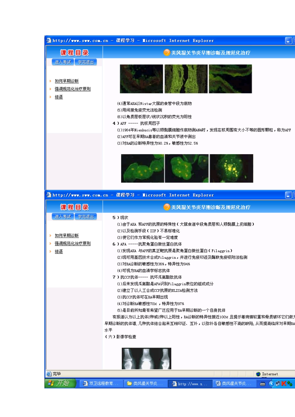 类风湿关节炎早期诊断及规范化治疗_第3页