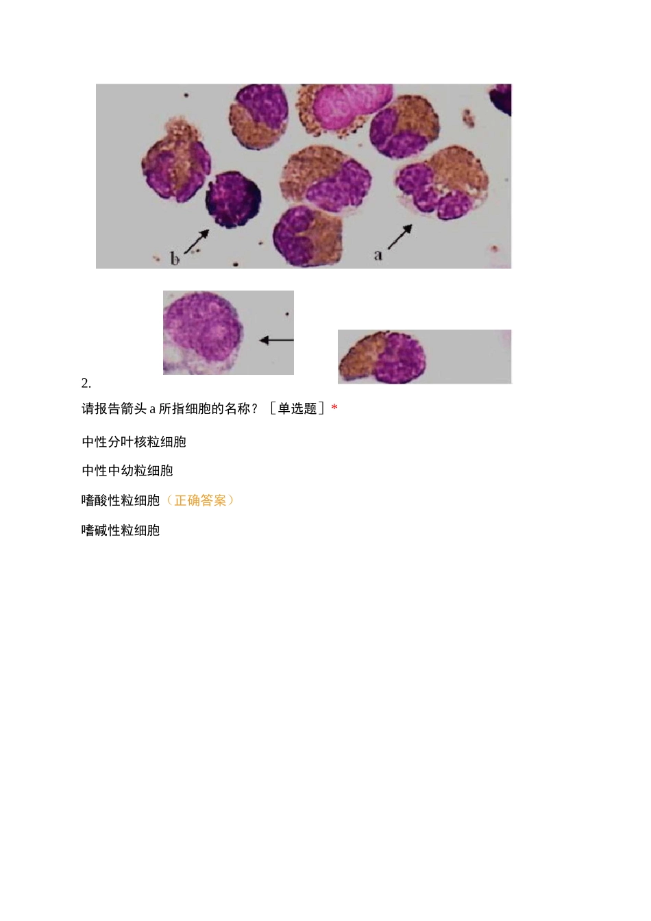 外周血细胞形态学、直方图及散点图知识竞赛_第2页