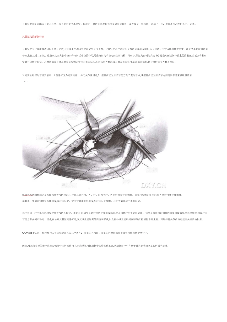 尺骨冠突骨折_第1页