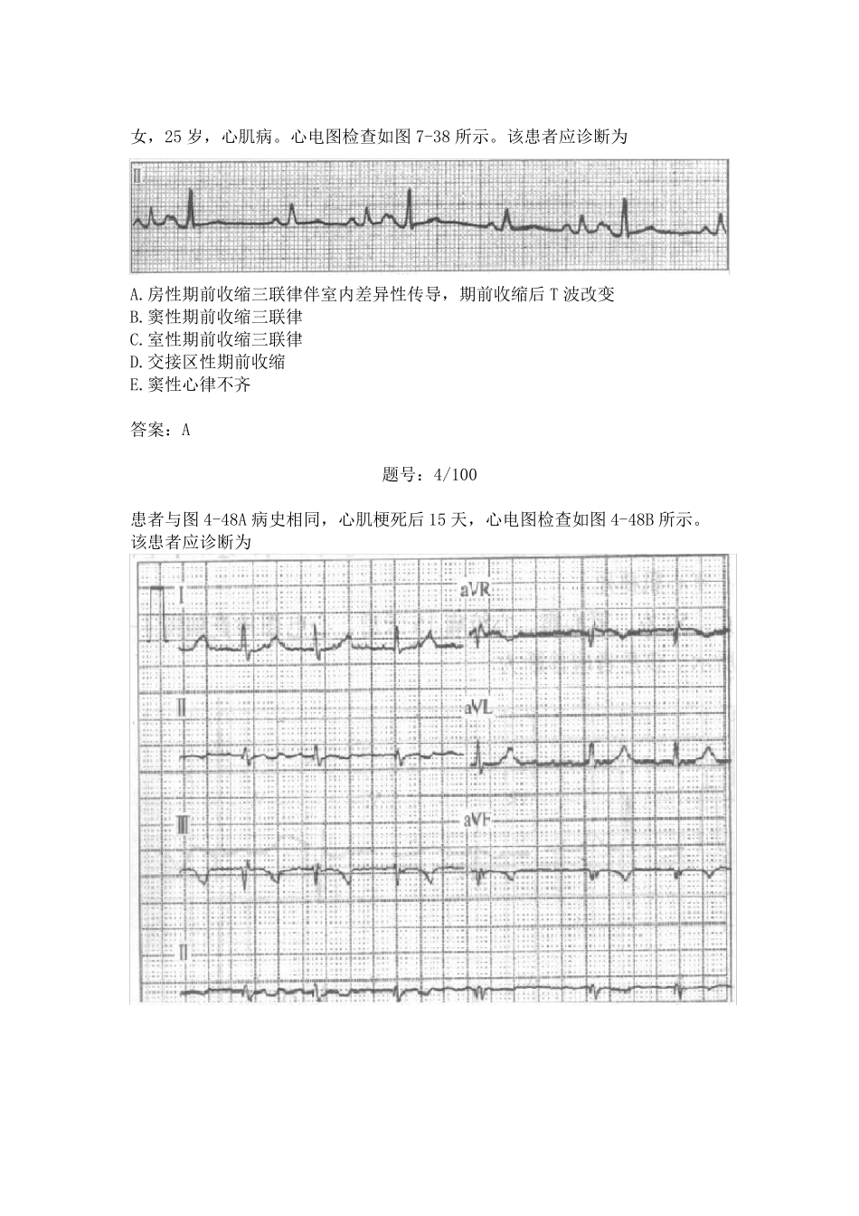2011年三基考核试题(心电图)_第2页