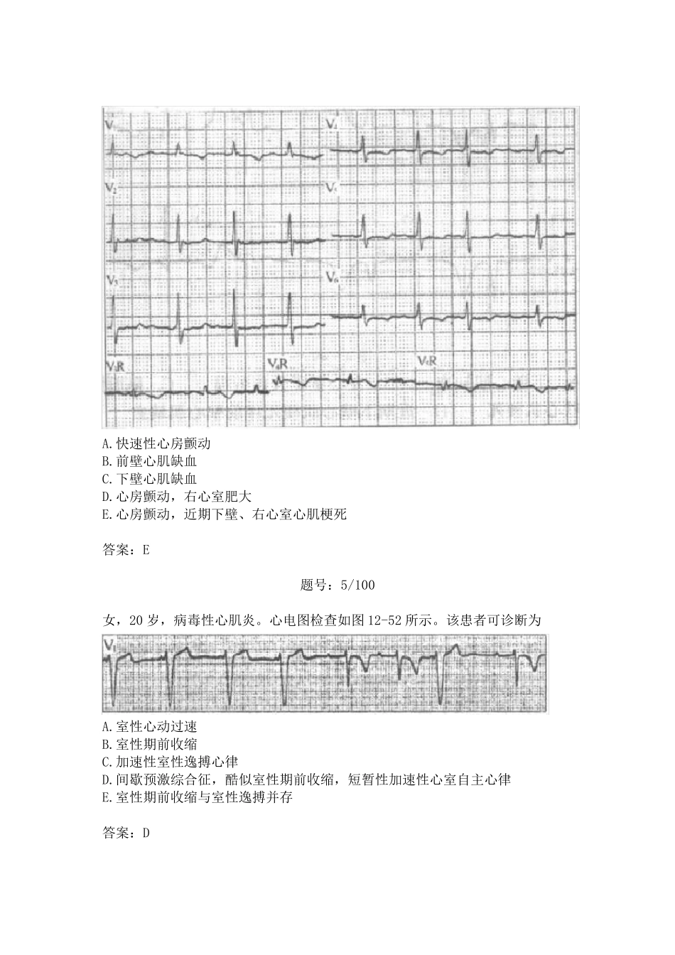 2011年三基考核试题(心电图)_第3页