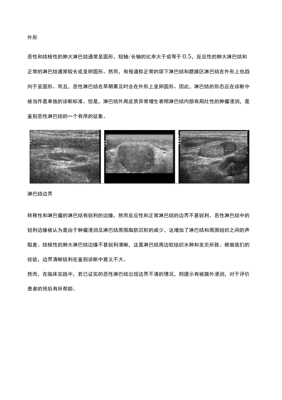 颈部淋巴结的超声诊断_第2页
