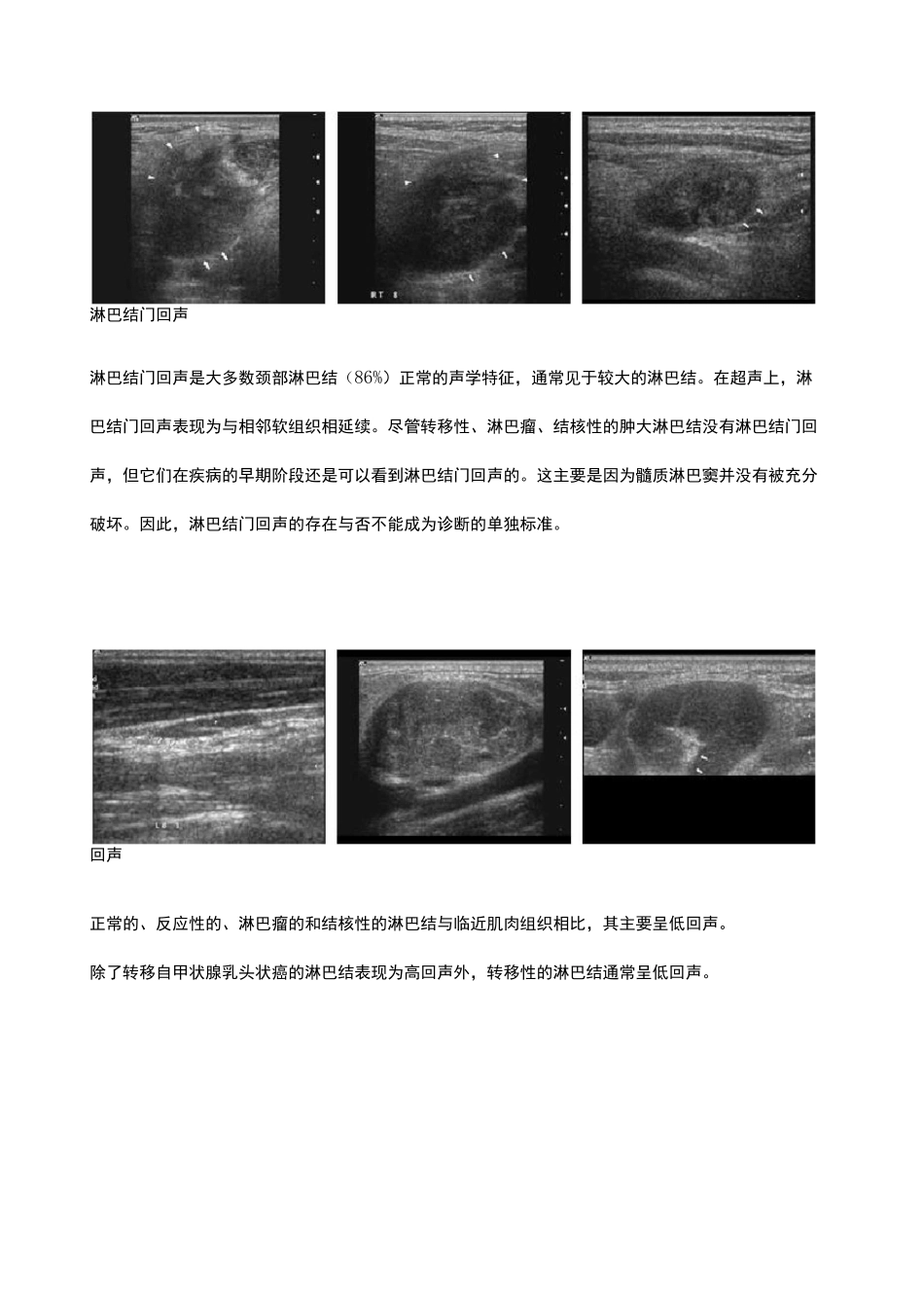 颈部淋巴结的超声诊断_第3页
