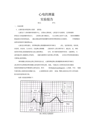 心电试验报告