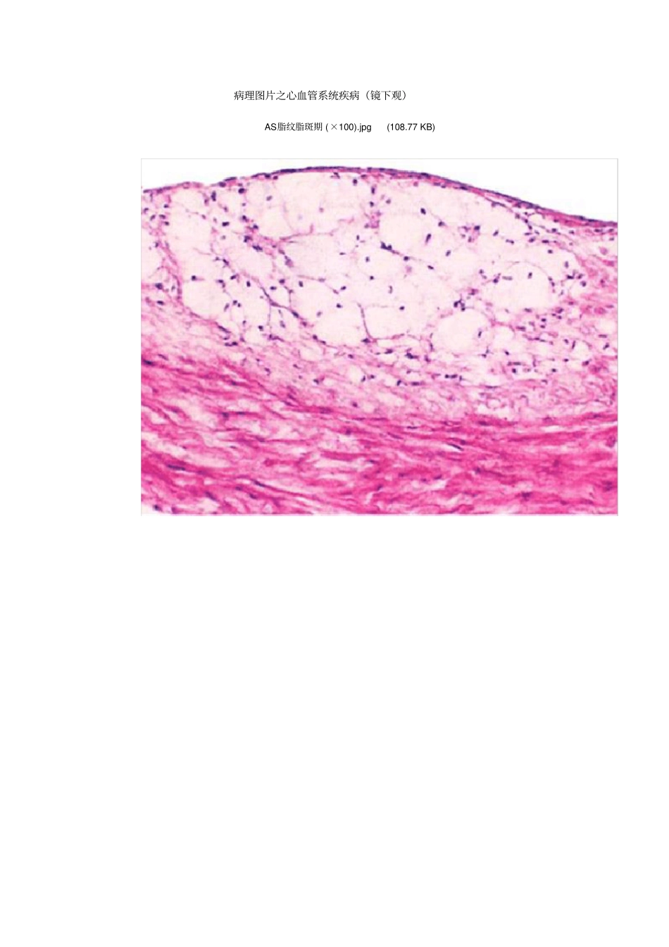 心血管系统疾病镜下观_第1页