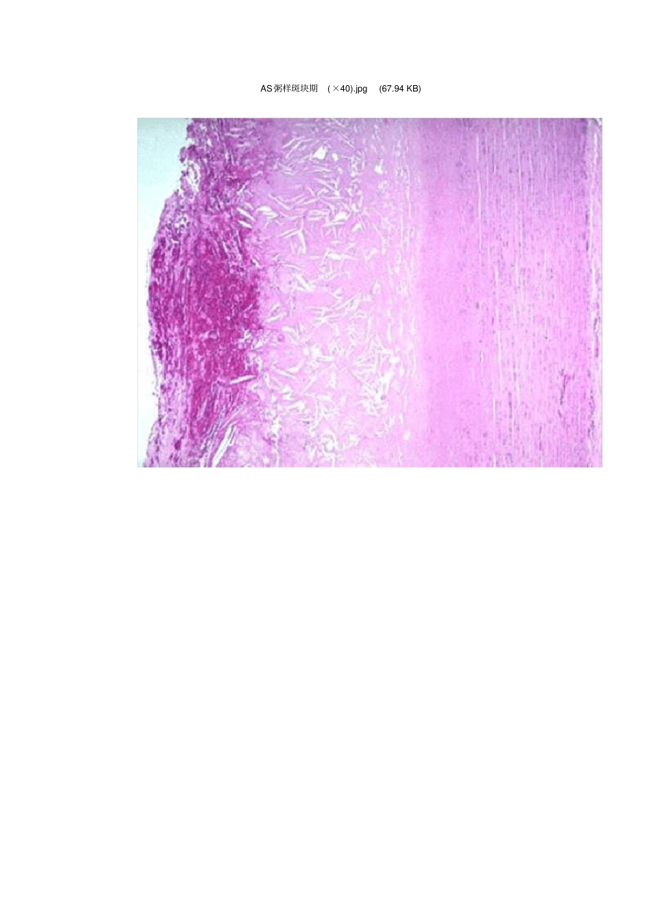 心血管系统疾病镜下观_第2页