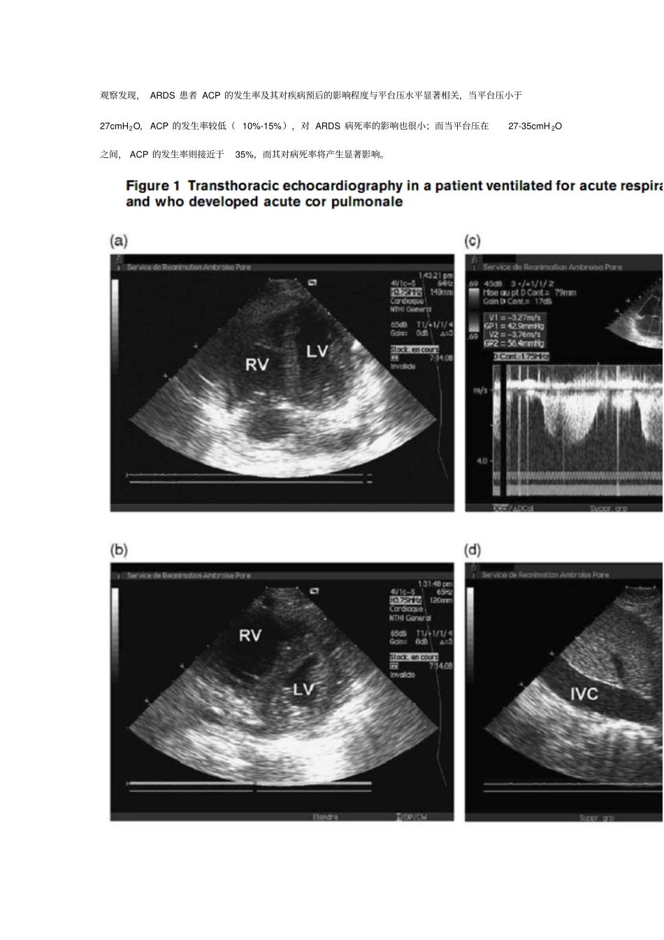 急性呼吸窘迫综合征、机械通气与右心室功能Microsoft文档_第2页