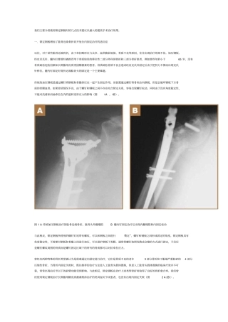 我们主要简介使用锁定钢板时几点技术建议以最大提高手术治疗效果