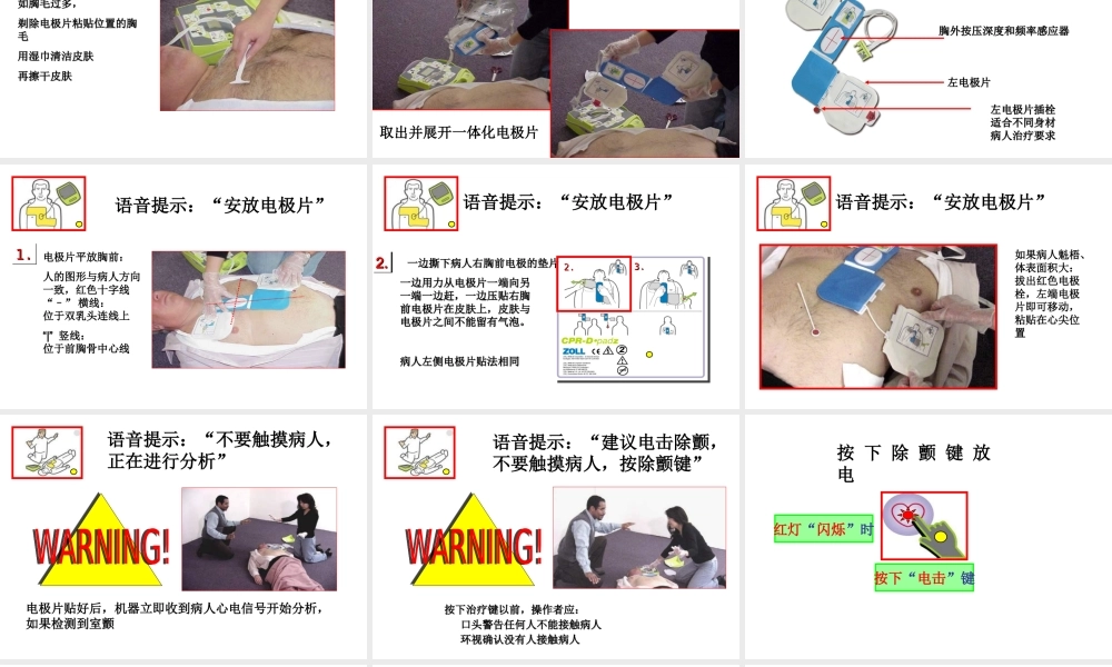 AED使用指南-课件