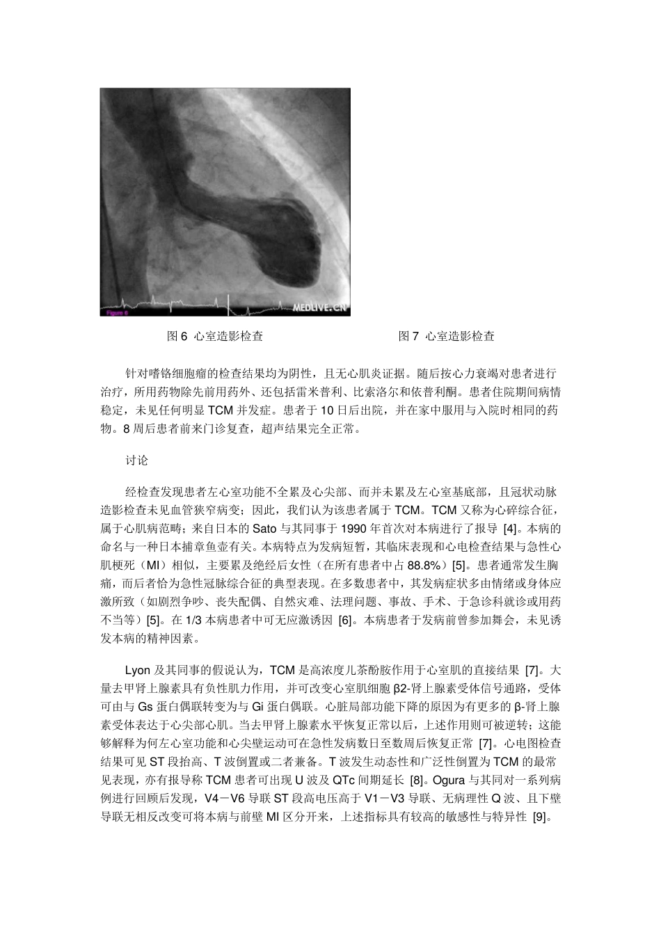 Takotsubo心肌病_第3页
