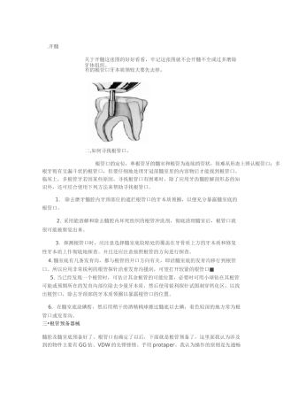 各牙的开髓洞型