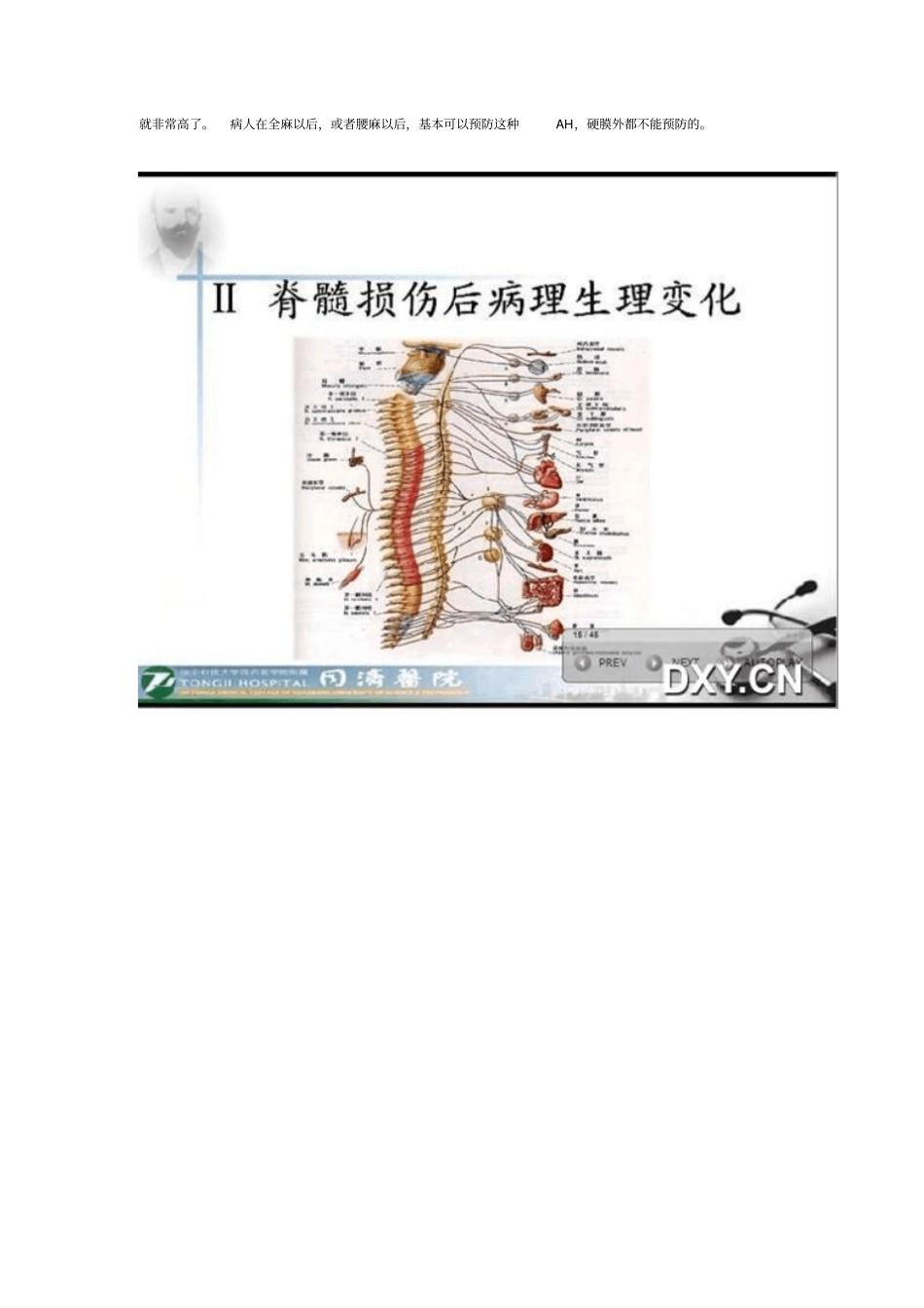 截瘫病人的麻醉_第2页