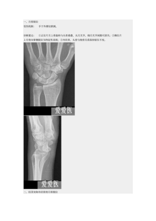 手骨脱位小骨详解