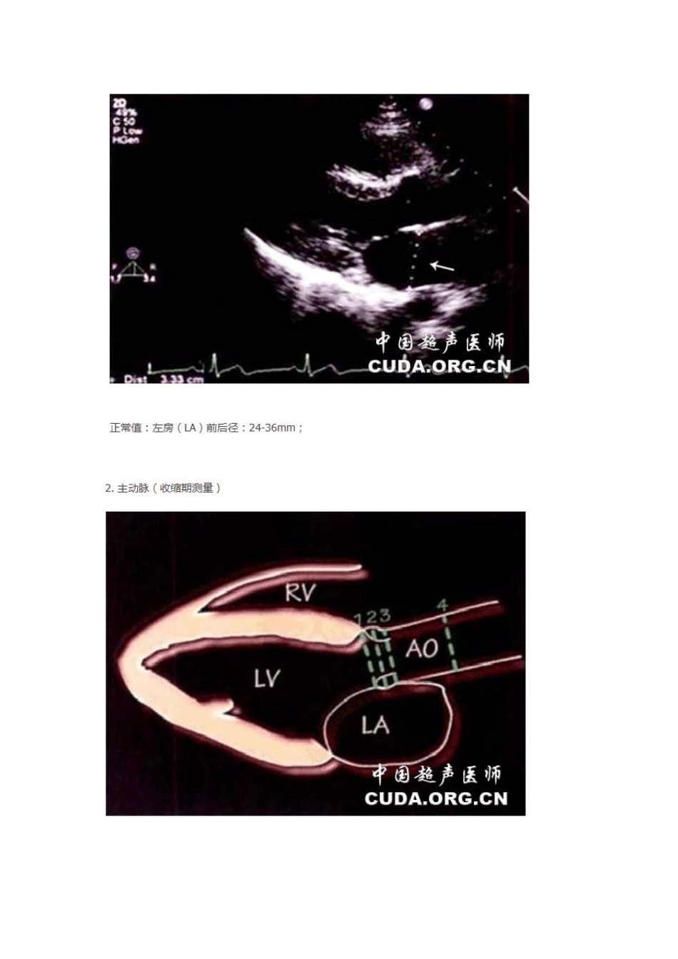 二维心脏超声测量图解_第2页