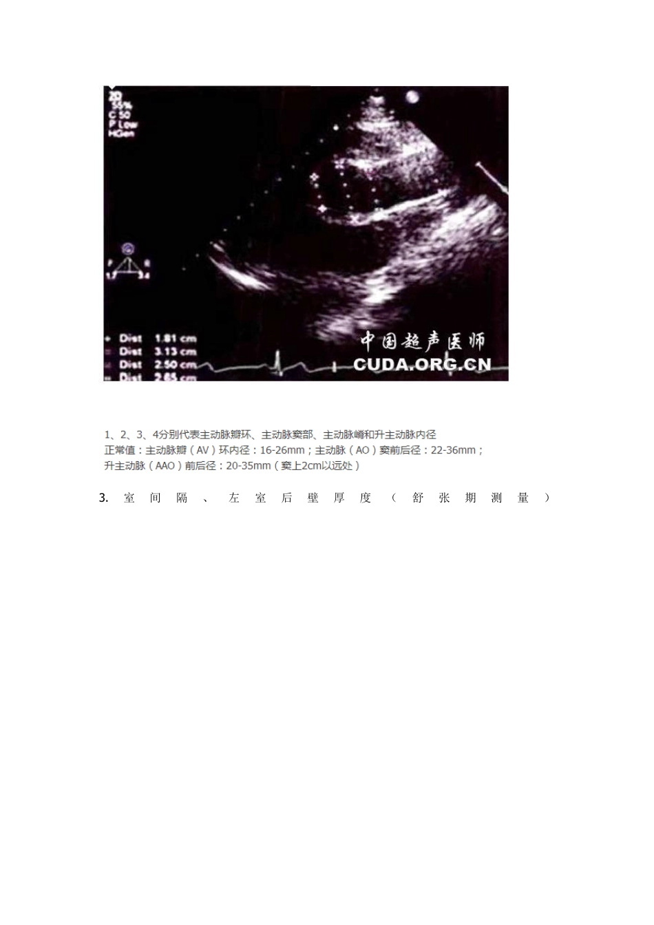 二维心脏超声测量图解_第3页