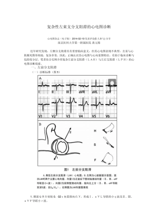 复杂性左束支分支阻滞的心电图诊断
