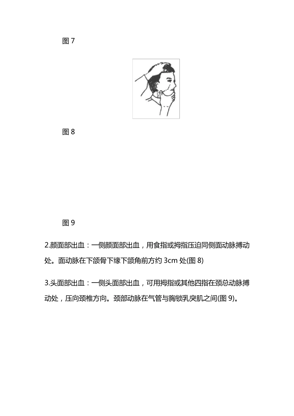 外伤出血急救_第3页